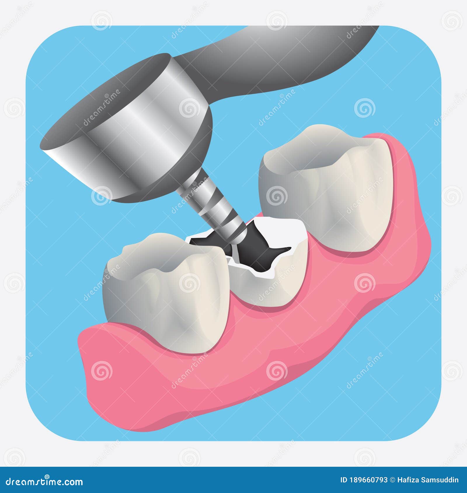Teeth with Dental Drill. Vector Illustration Decorative Design Stock