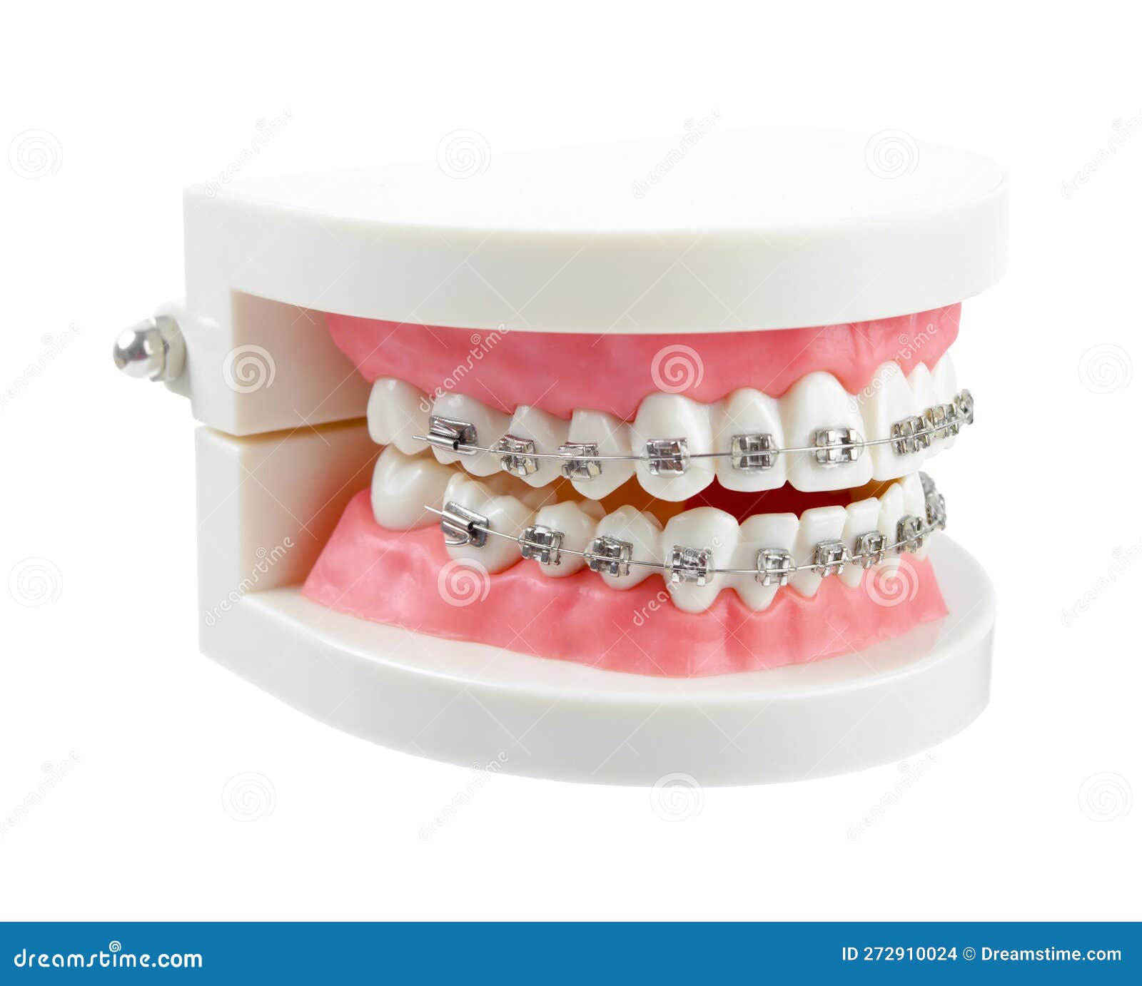 The Teeth Model with Metal Wire Dental Braces or Dental Instruments