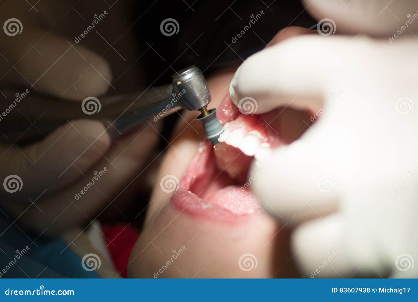 Teeth Polishing and Cleaning Stock Photo Image of doctor, health