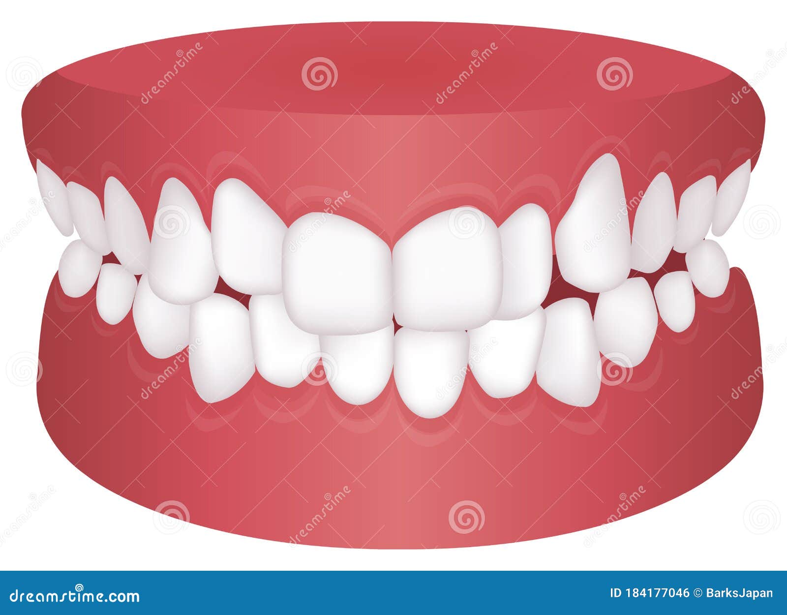 Teeth Trouble Bite Type / Crooked Teeth Vector Illustration /Crossbite