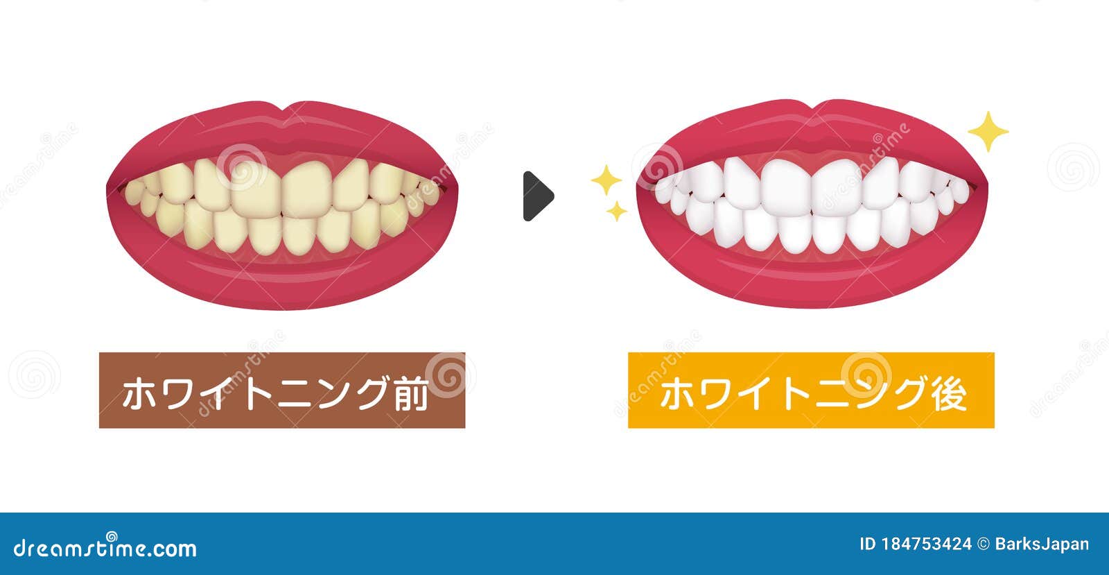 Teeth Whitening Vector Illustration / before and after Japanese Stock