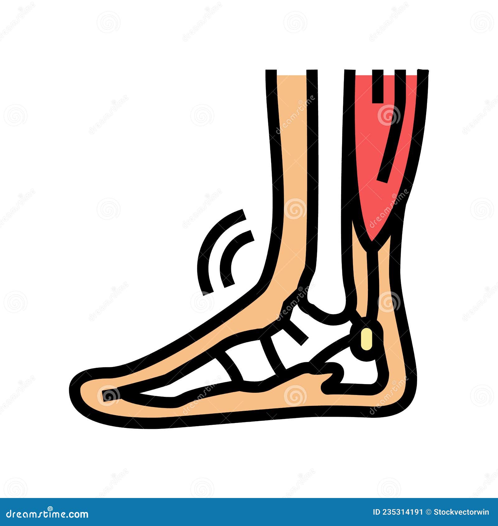 tendonitis problem color icon  