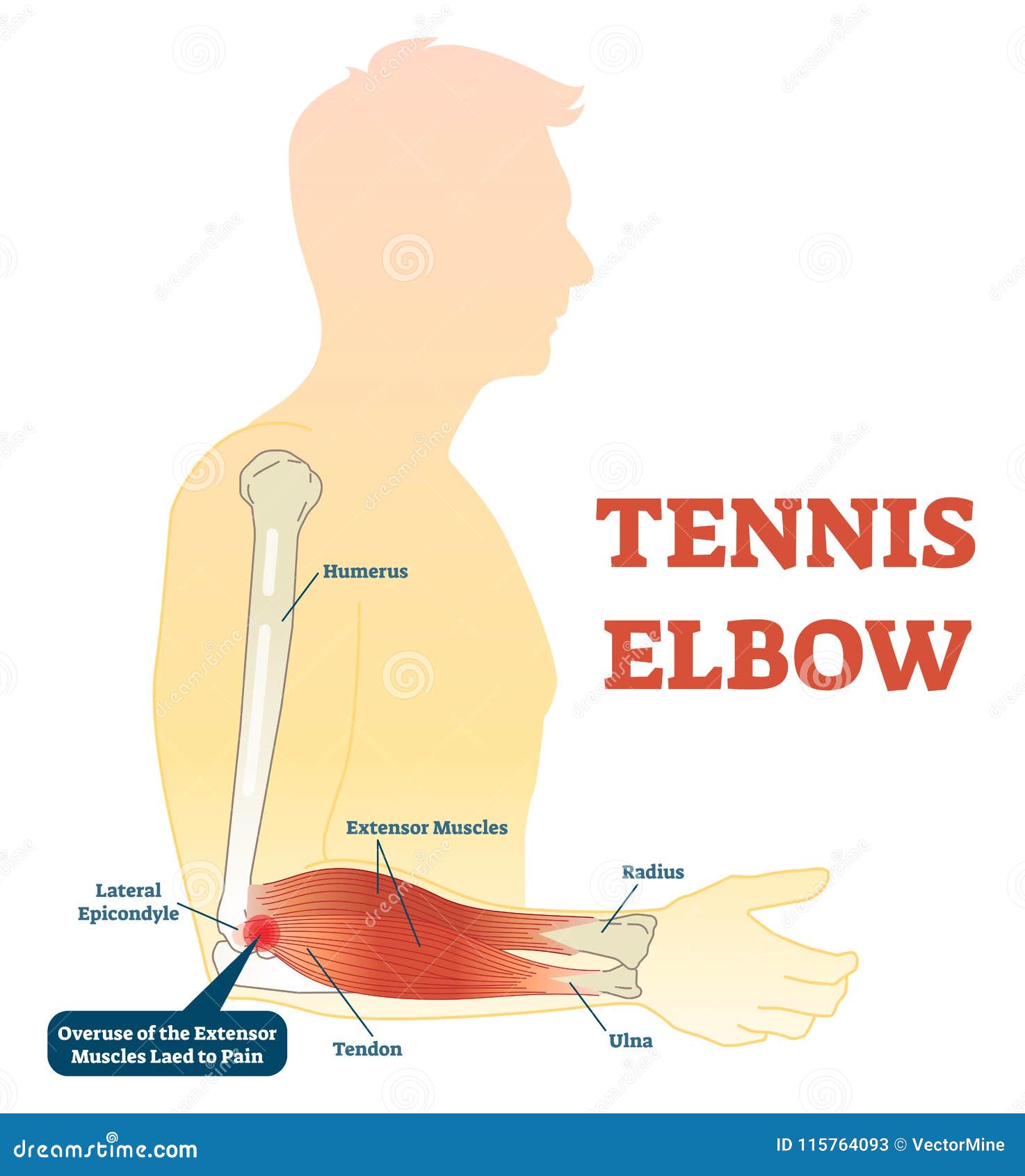 Extensor Muscles Diagram Biology Diagrams
