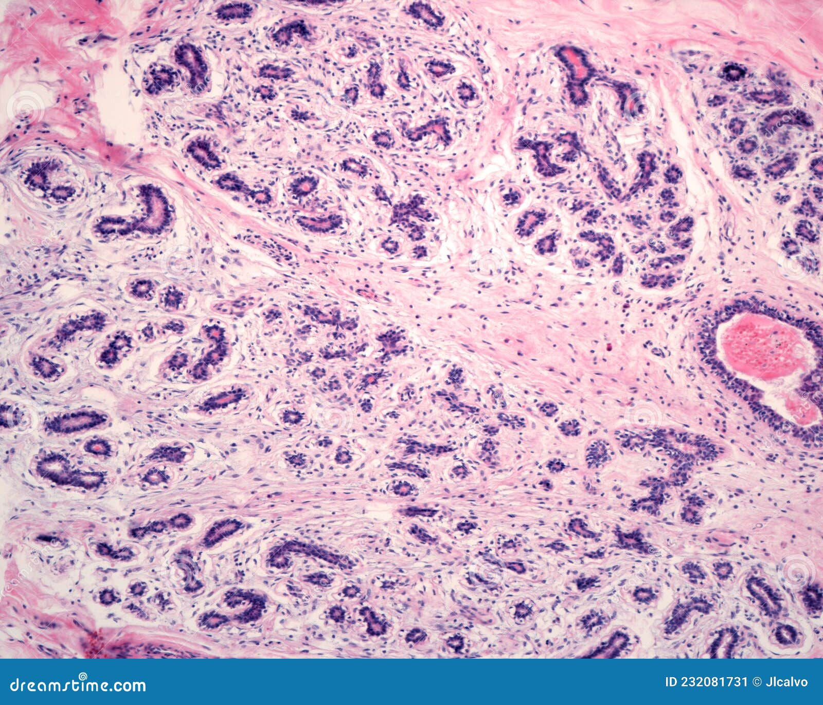 Human mamary gland. TDLU stock image. Image of epithelium - 232081731