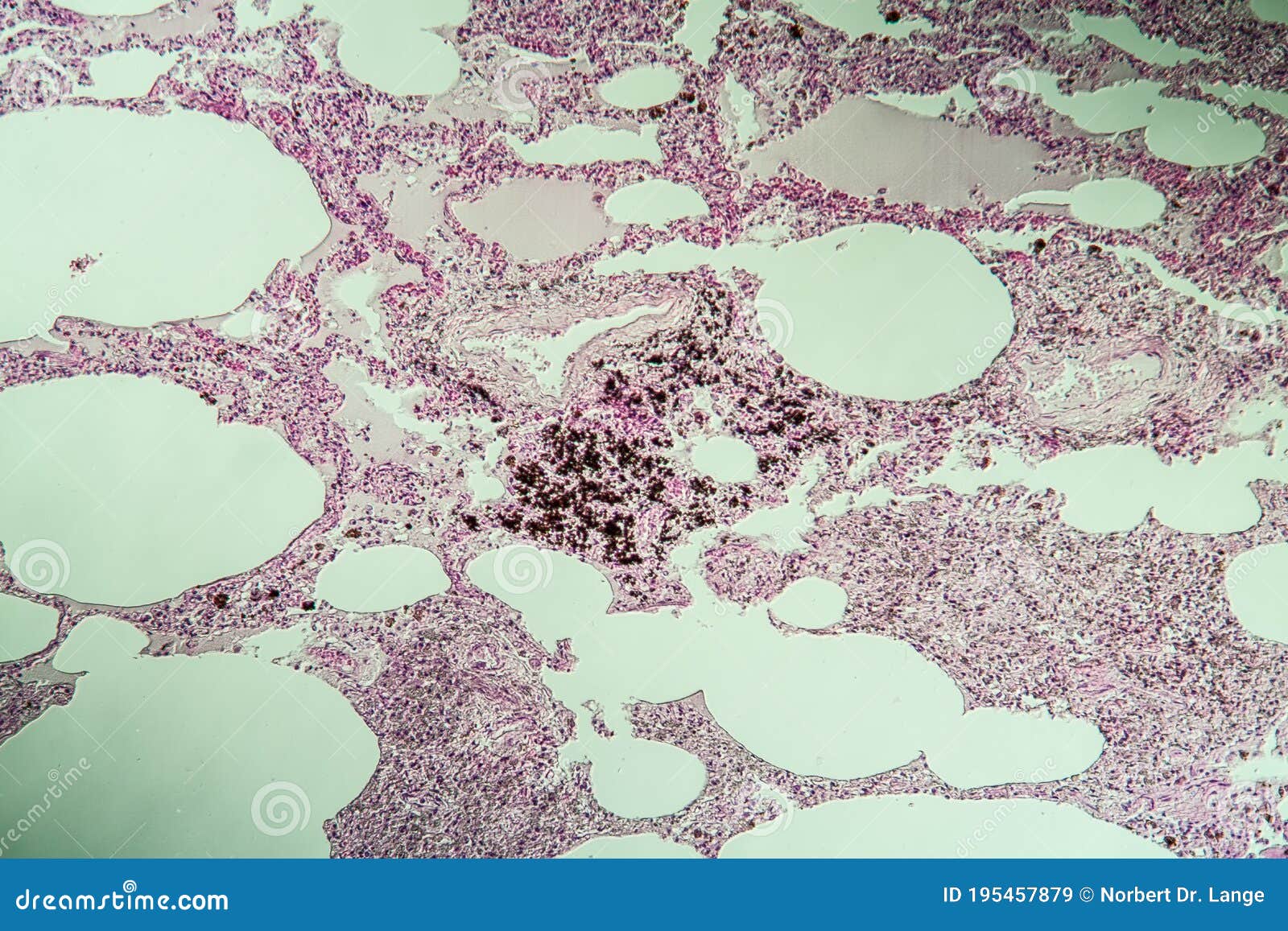 Tessuto Polmonare Sotto Il Microscopio Immagine Stock - Immagine di  polvere, cellule: 195457879