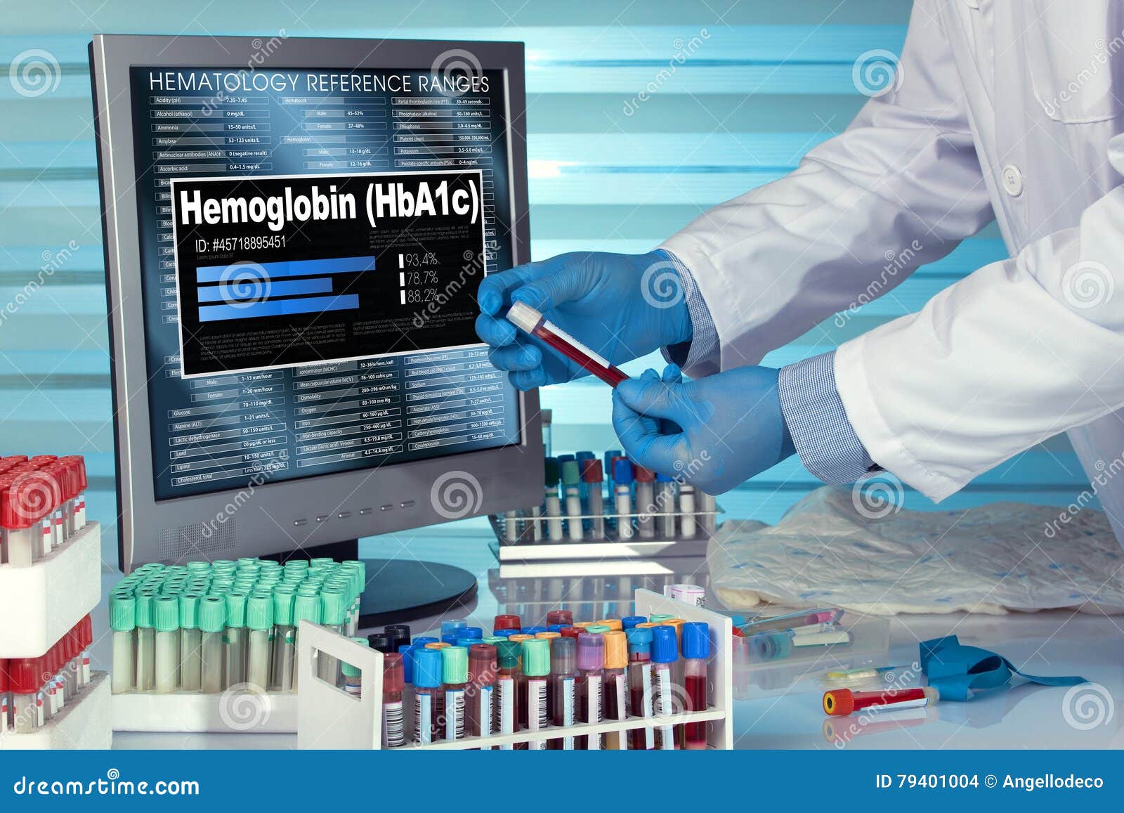 Test of Hemoglobin HbA1c. Technician in Lab Examining Blood Sample with