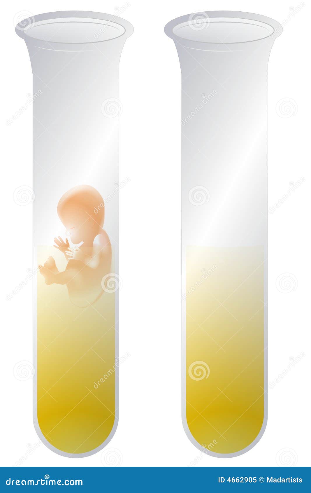 Test Tube Baby stock illustration. Illustration of clipart 4662905