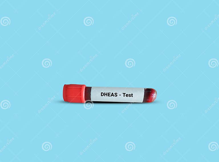 Test Tube with Blood Sample for DHEAS Test. Stock Image Image of