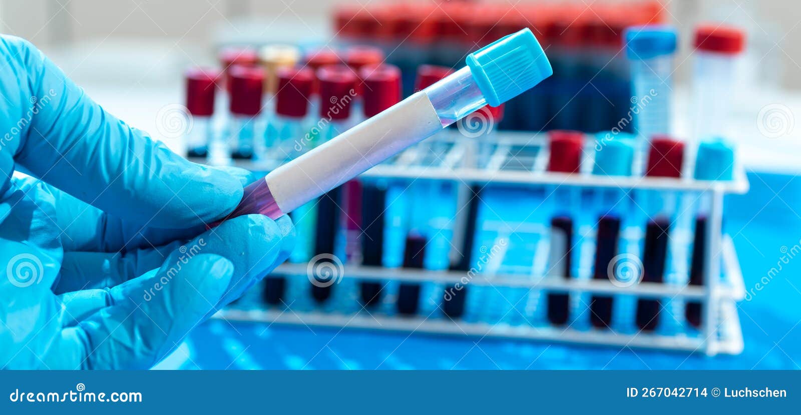 Test Tube with Empty Label To Laboratory Research Stock Photo Image