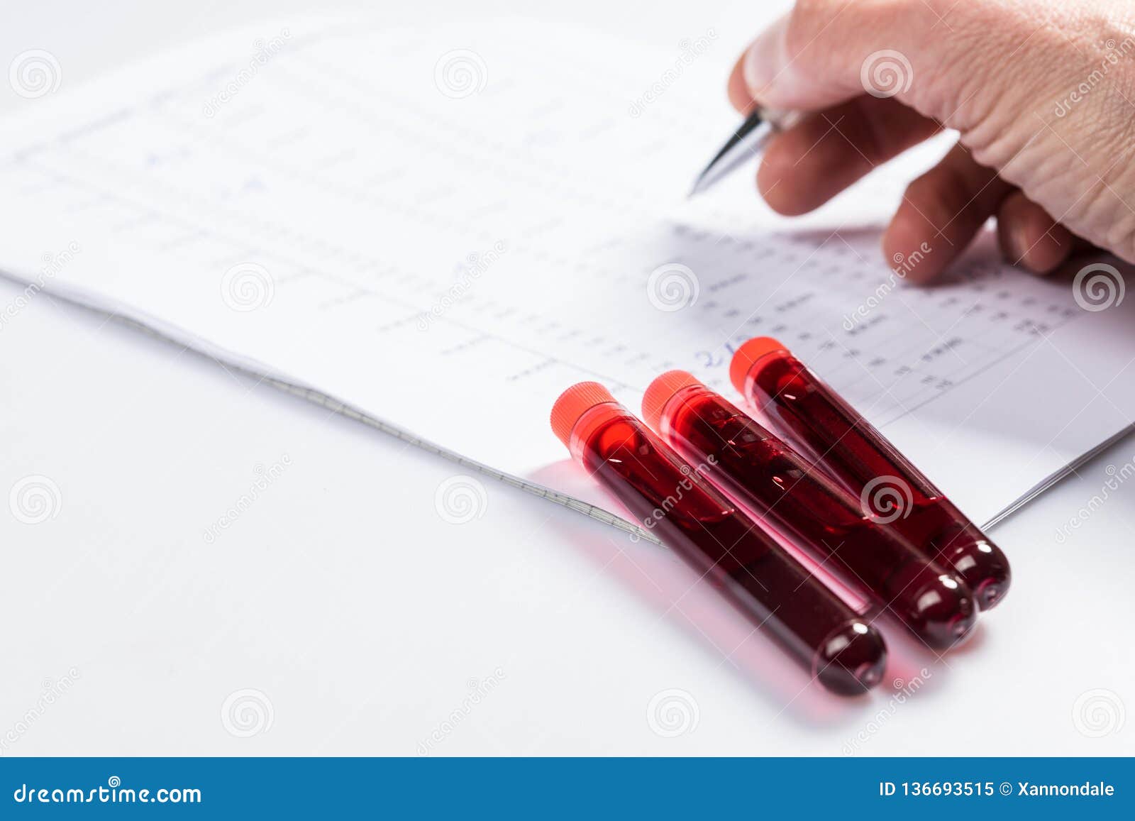 Blood Test Tube Chart