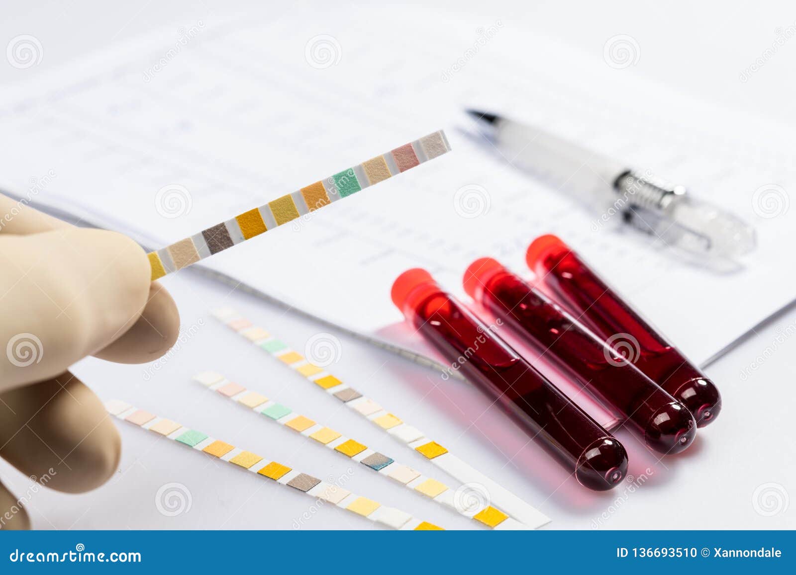 Blood Collection Tubes And Tests Chart