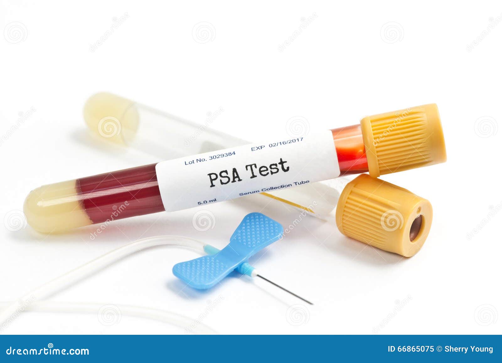 Teste da PSA. Tubo da coleção da análise da PSA com fontes e relatório da coleção do sangue