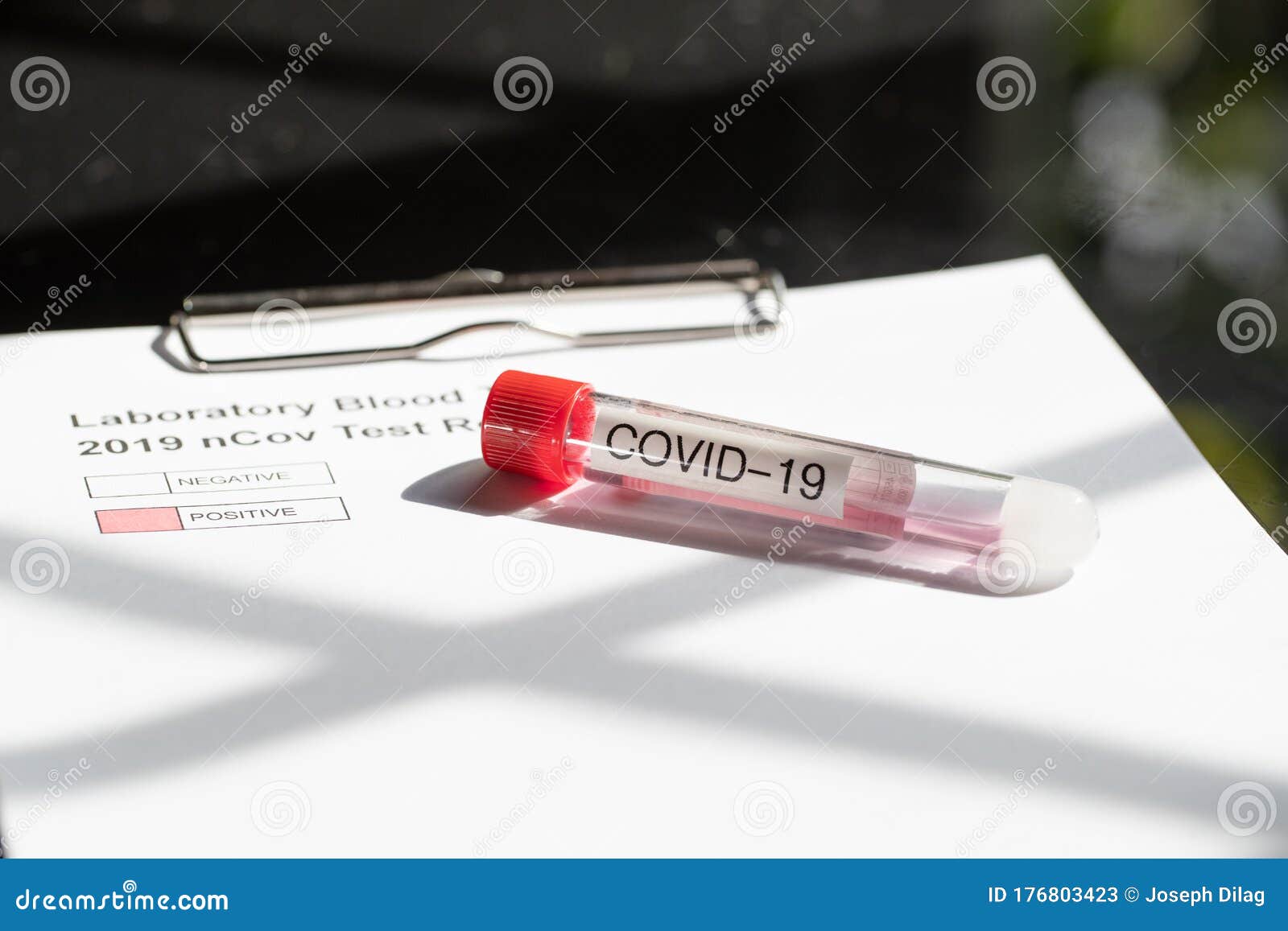 testing kit for ncov, covid - 19, corona virus testing tube in laboratory
