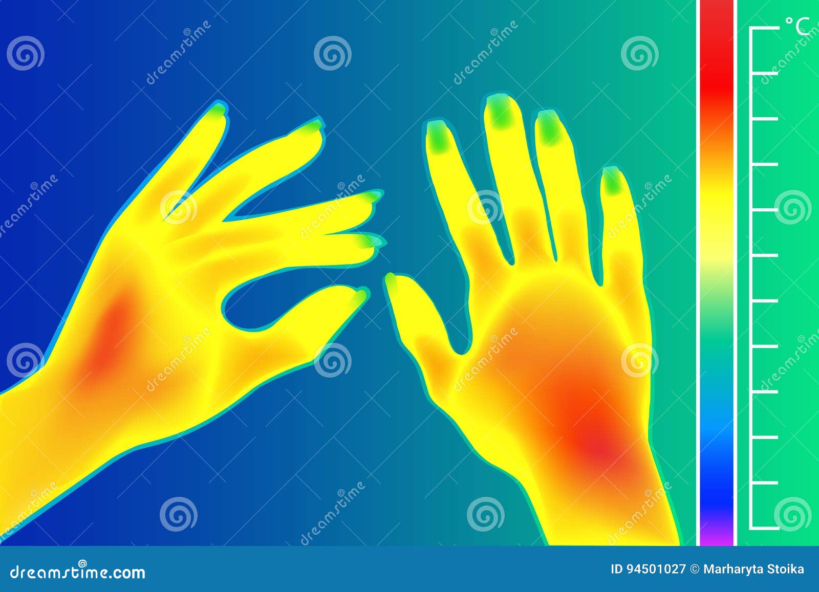 Thermal Imager Human Hands. the Image of Arms Using Infrared