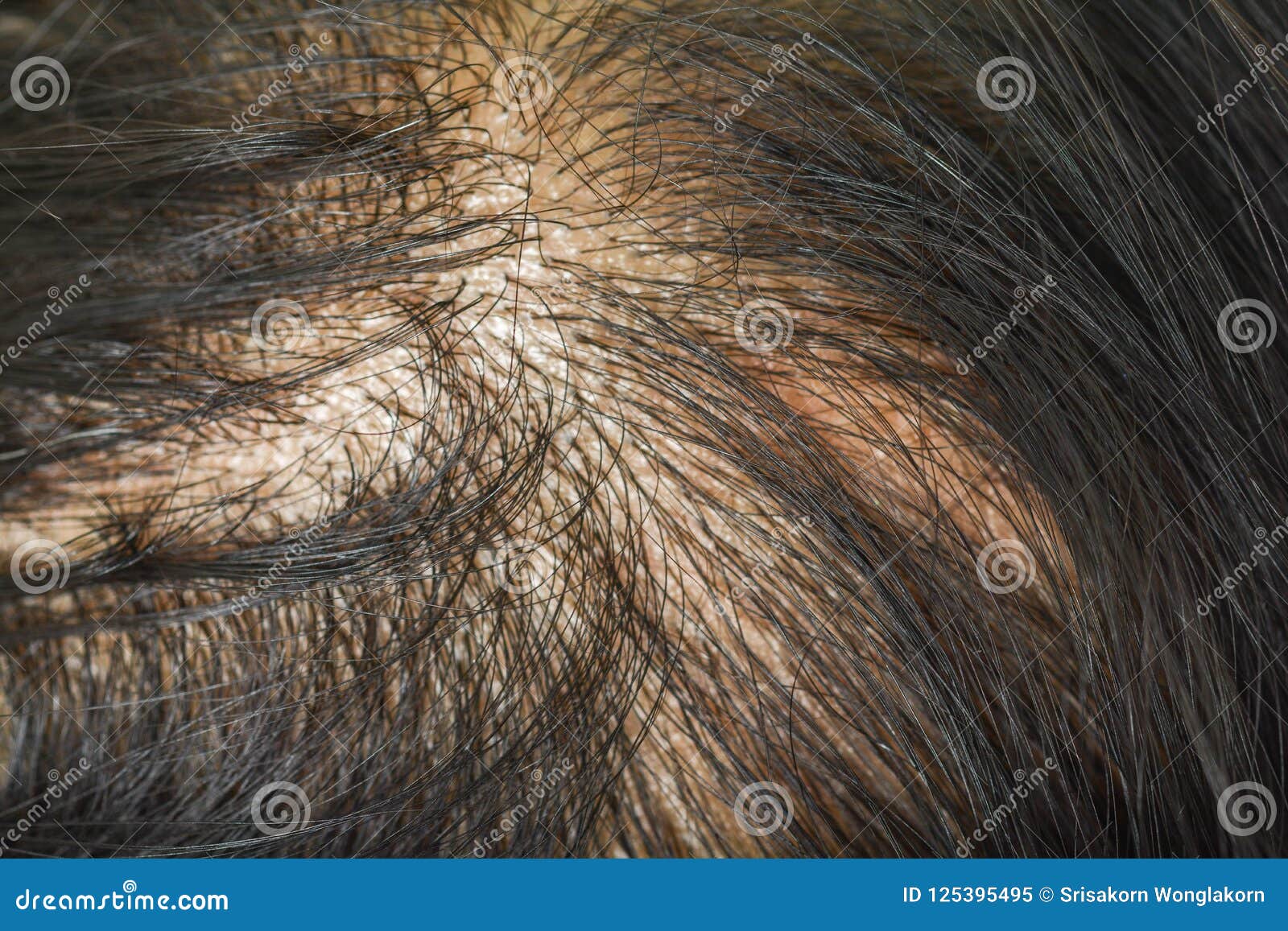 451 Itching Scalp Stock Photos - Free & Royalty-Free Stock Photos from  Dreamstime
