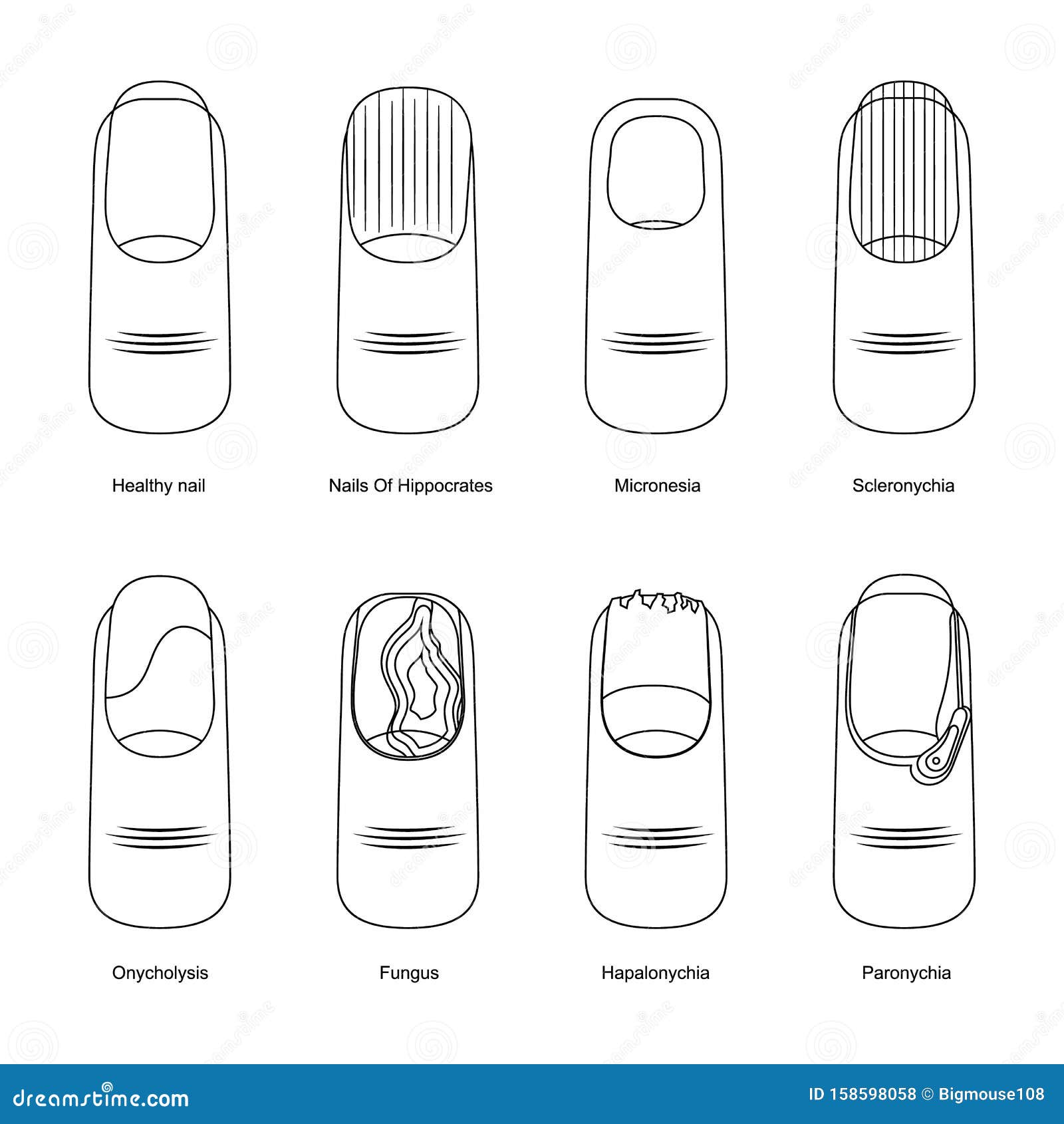 Thin Line Design Nail Diseases Icon Set. Vector Stock Vector