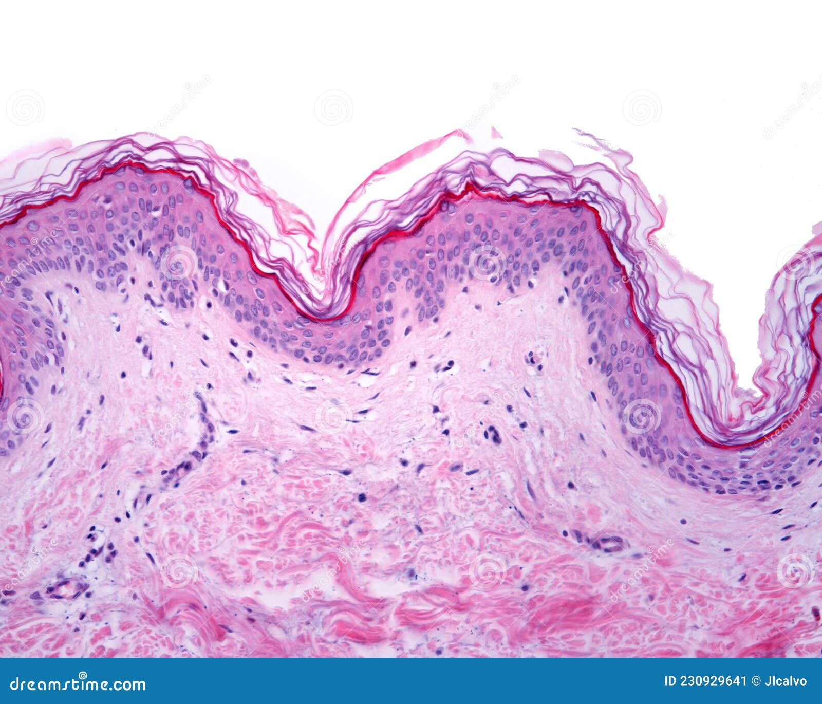 thin skin. epidermis and dermis