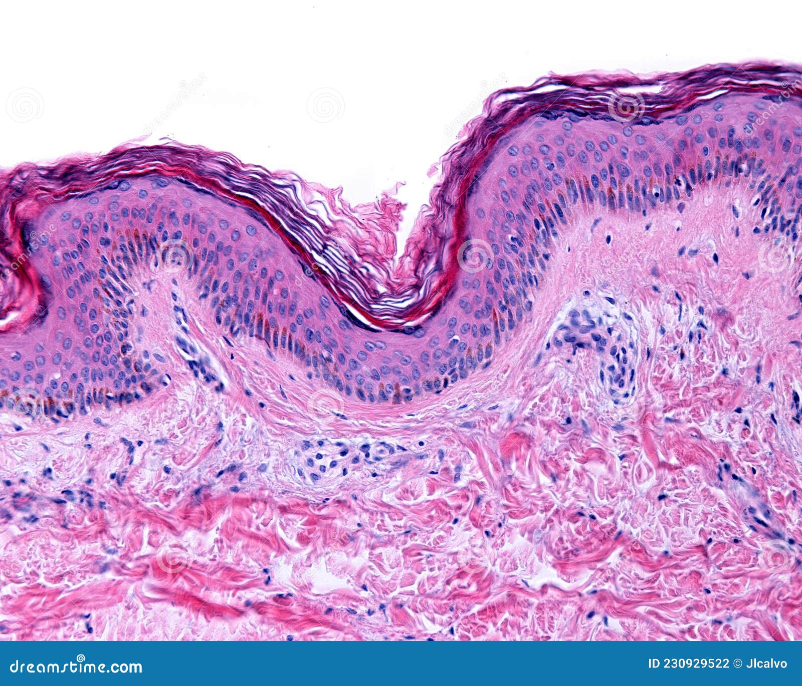 Histology Of Skin Stained With Hande Stock Photography Cartoondealer