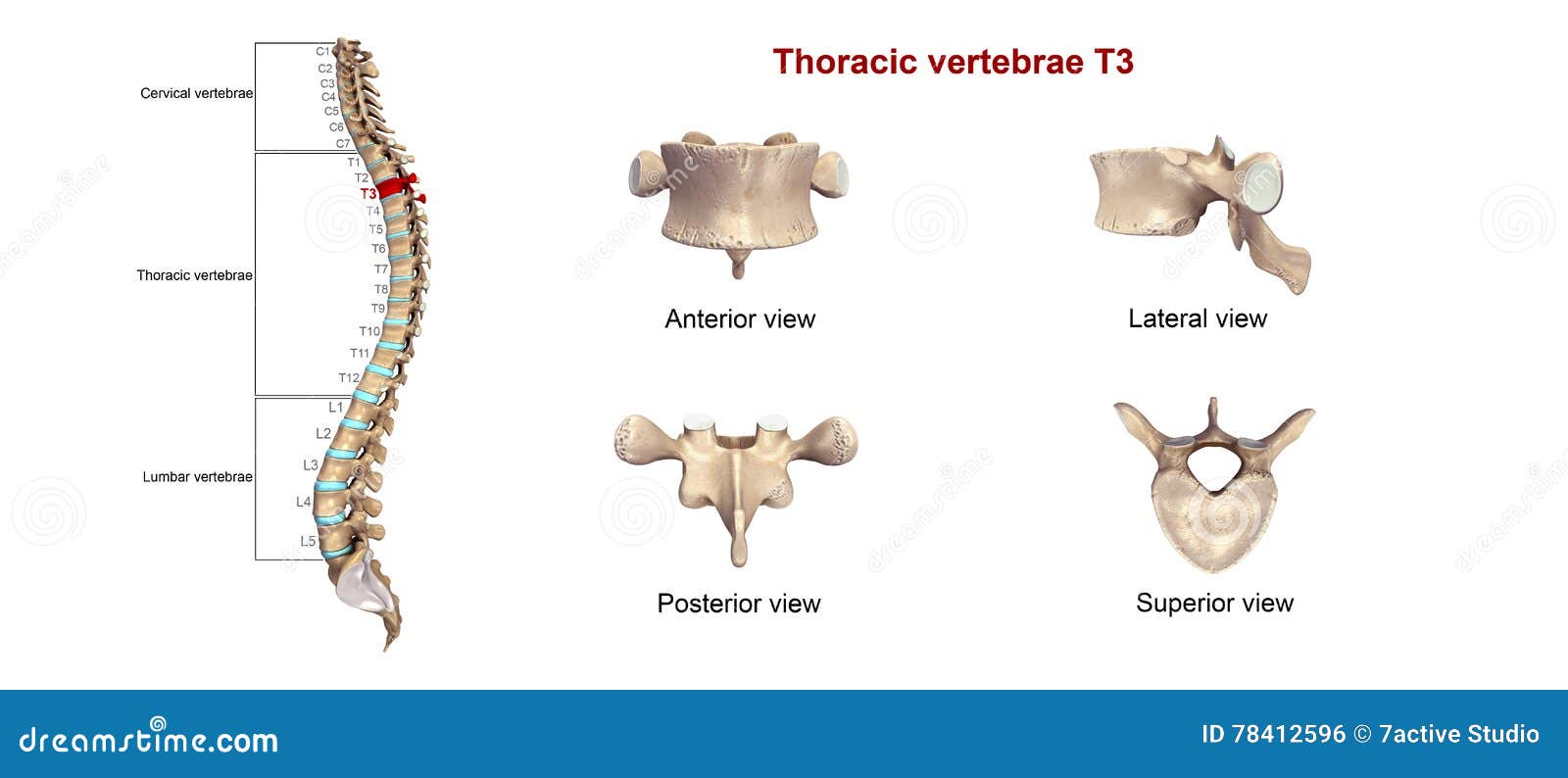 thoracic vertebrae t3