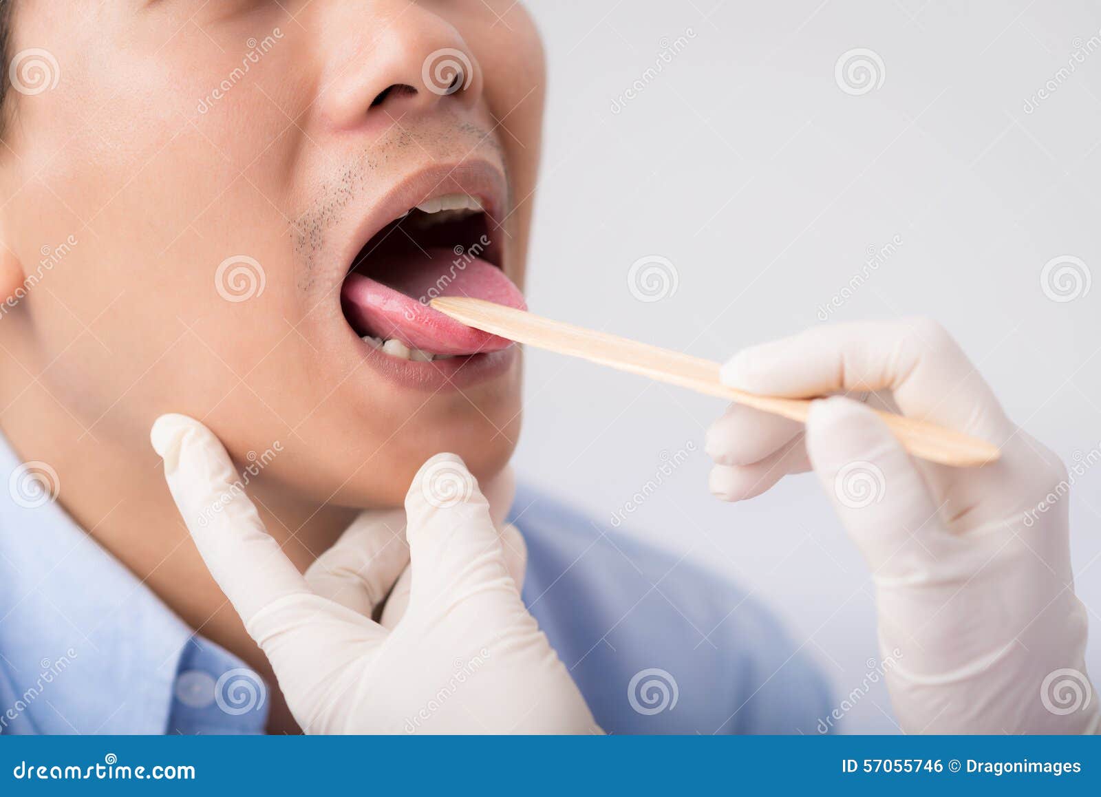 Throat check-up stock photo. Image of throat, closeup - 57055746