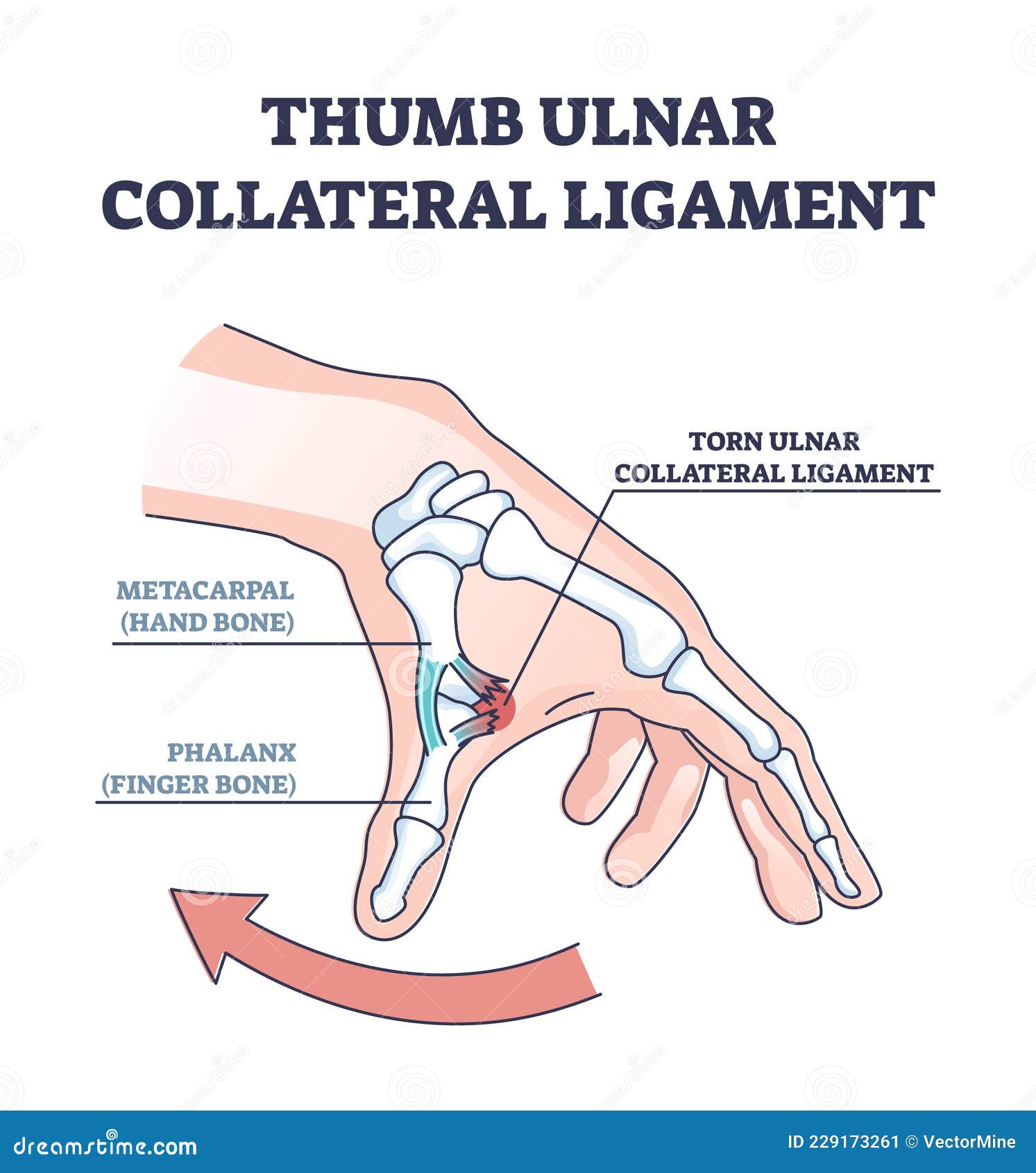thumb ulnar collateral ligament as finger injury and problem outline diagram