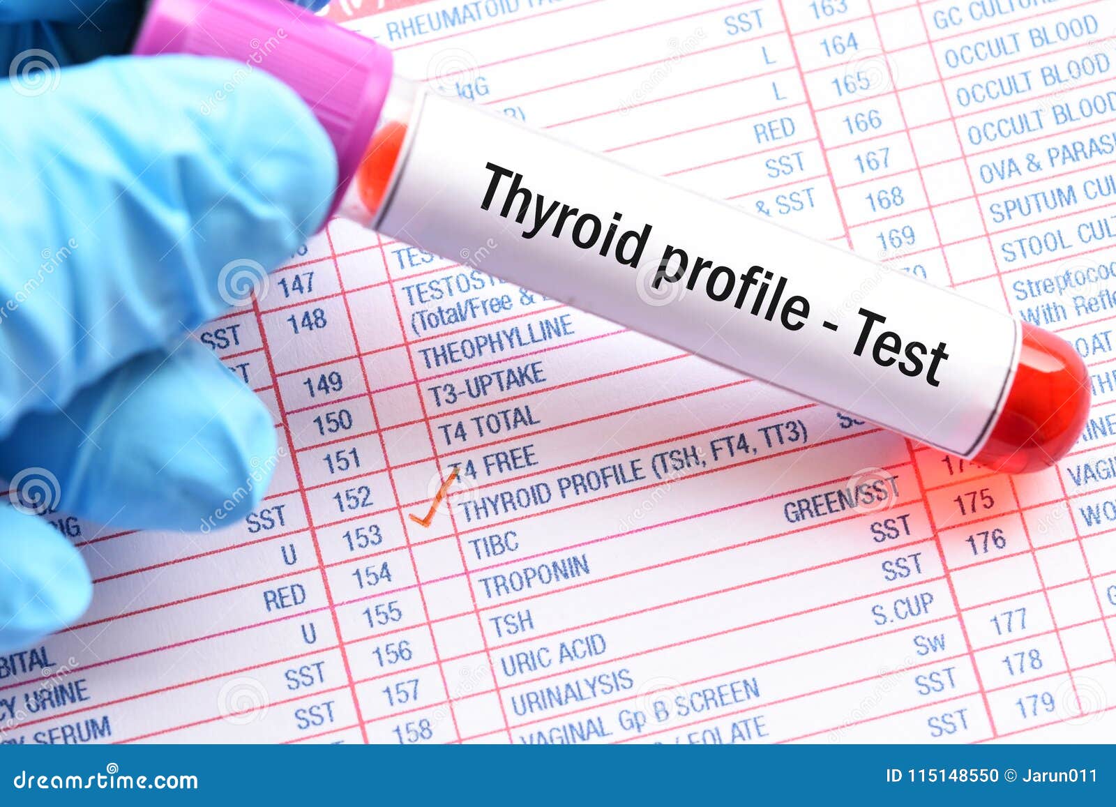 Thyroid Profile Test Stock Photo Image Of Exam Hyperthyroidism thyroid-profile-test-stock-photo-image-of-exam-hyperthyroidism