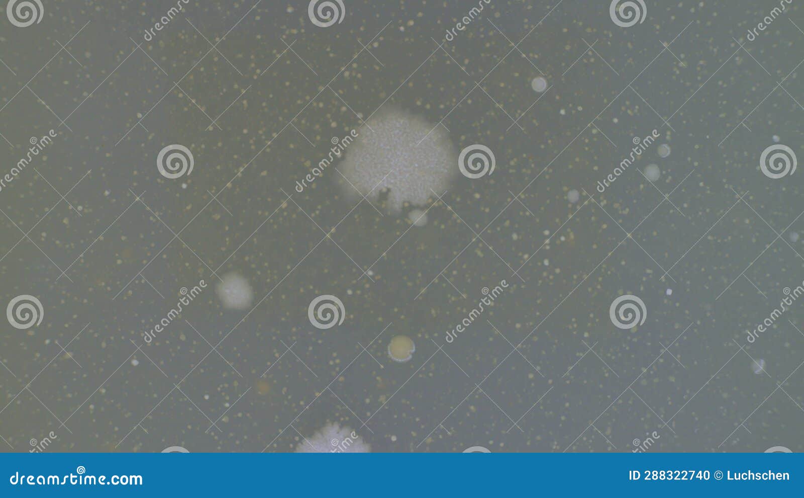 Time Lapse of Growth of Pathogenic Bacteria on Agar in a Petri Dish