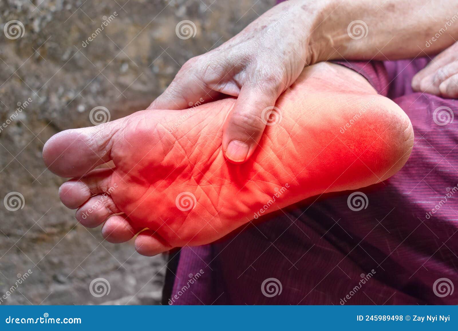 Tingling And Burning Sensation In Foot Of Asian Man Foot Pain Sensory
