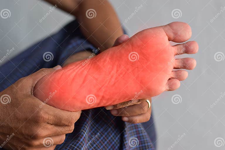 Tingling and Burning Sensation in Foot of Asian Man. Foot Pain. Sensory