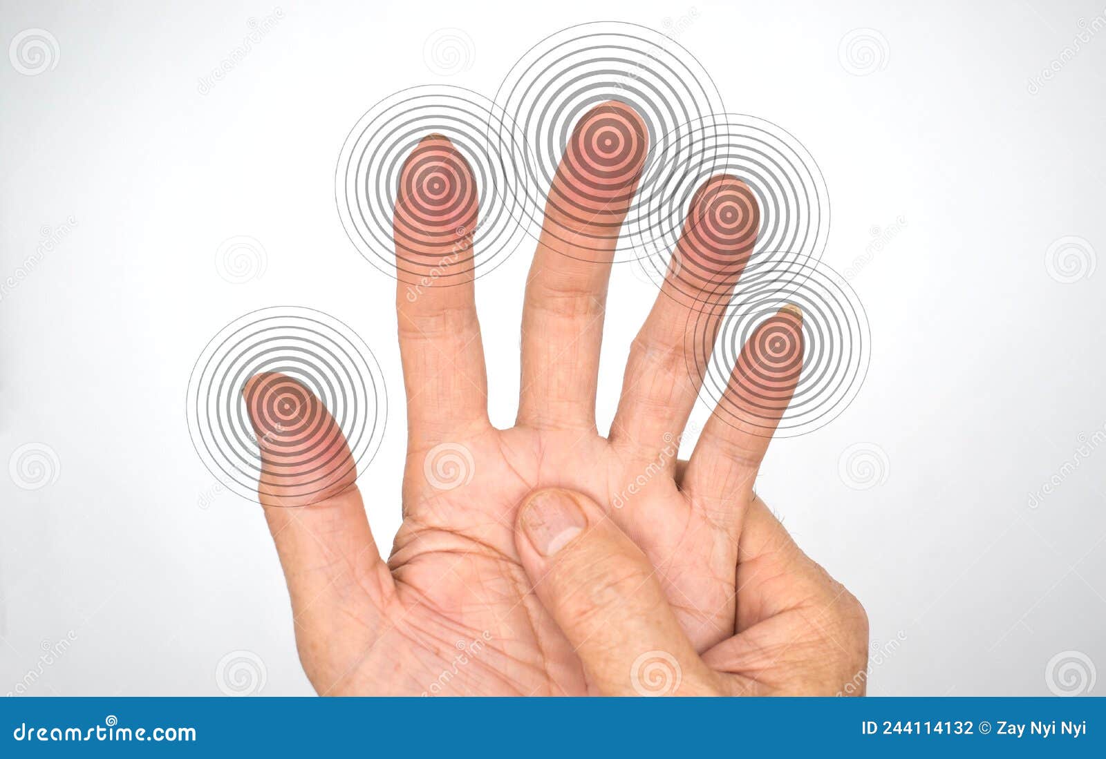 Tingling Sensation In Hands Of Asian Young Man With Diabetes. Sensory