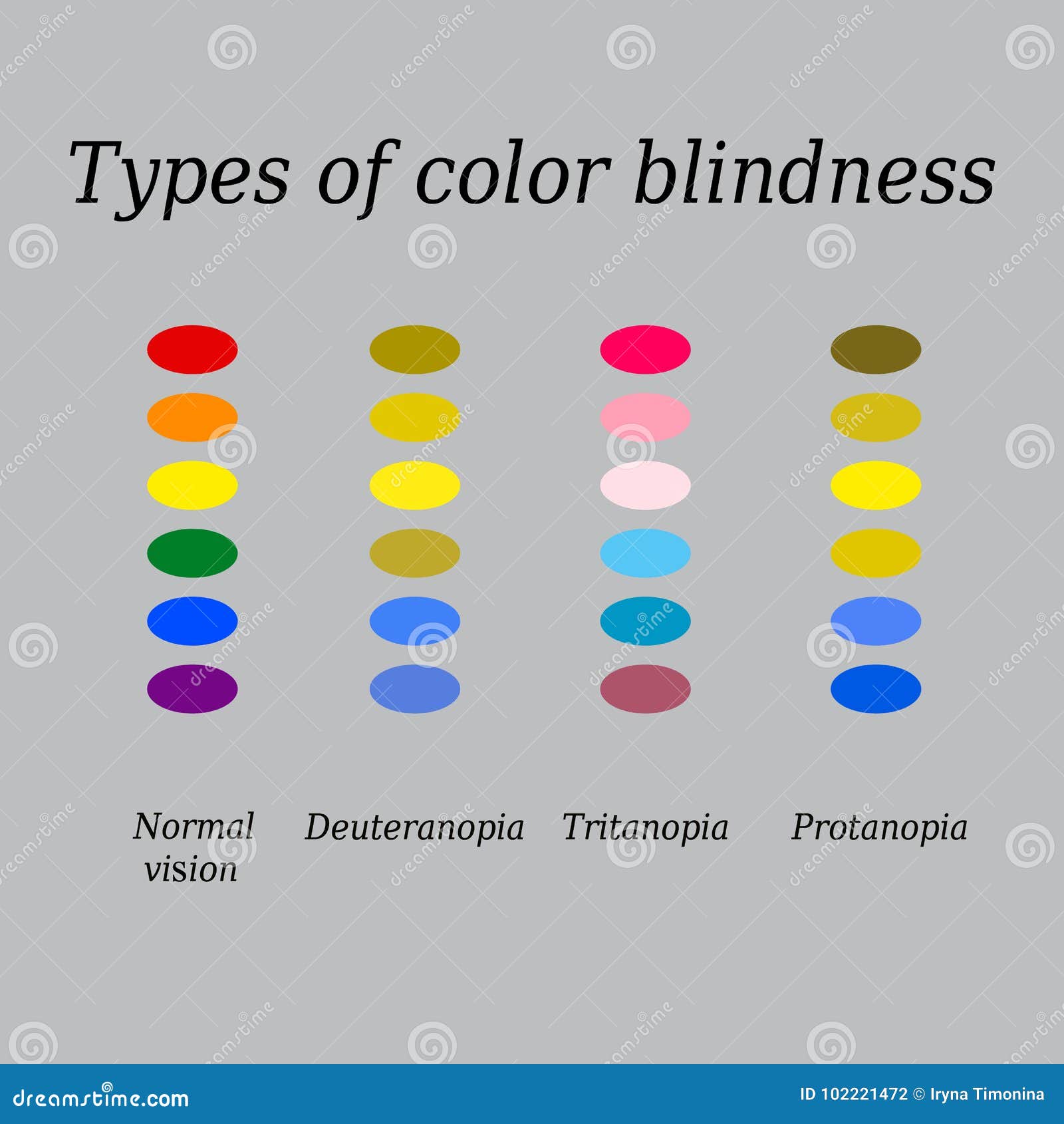 Tipi di daltonismi percezione di colore degli occhi illustrazione di ... Tipi di colori