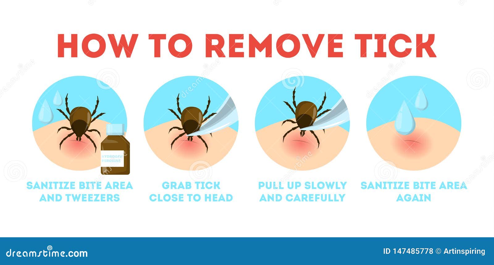 Tips for Tick Safety Infographic. How To Remove Mite Stock Vector