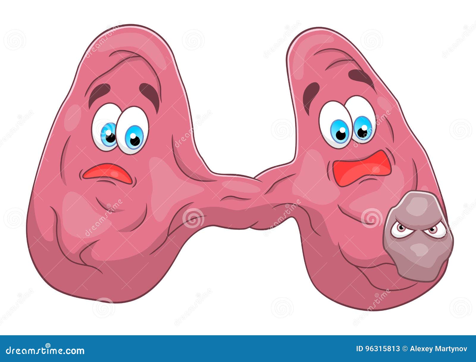 Tiroide Dos Desenhos Animados Com Câncer Ilustração do Vetor - Ilustração  de série, cartoon: 96315813, image size:1600x1218