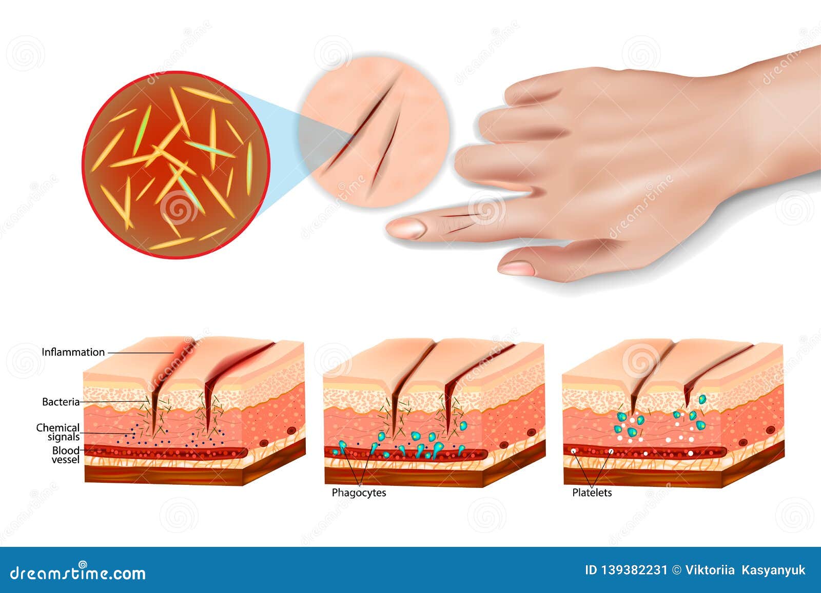 tissue injury and inflammation.