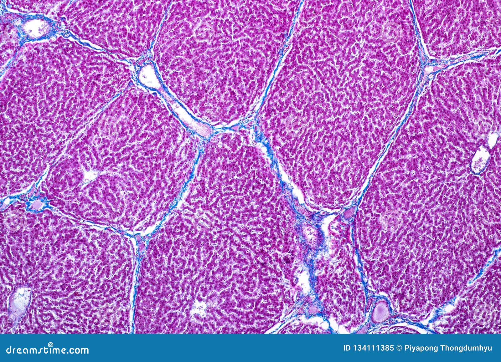 Tissue of Liver Under the Microscope for Education. Stock Image Image