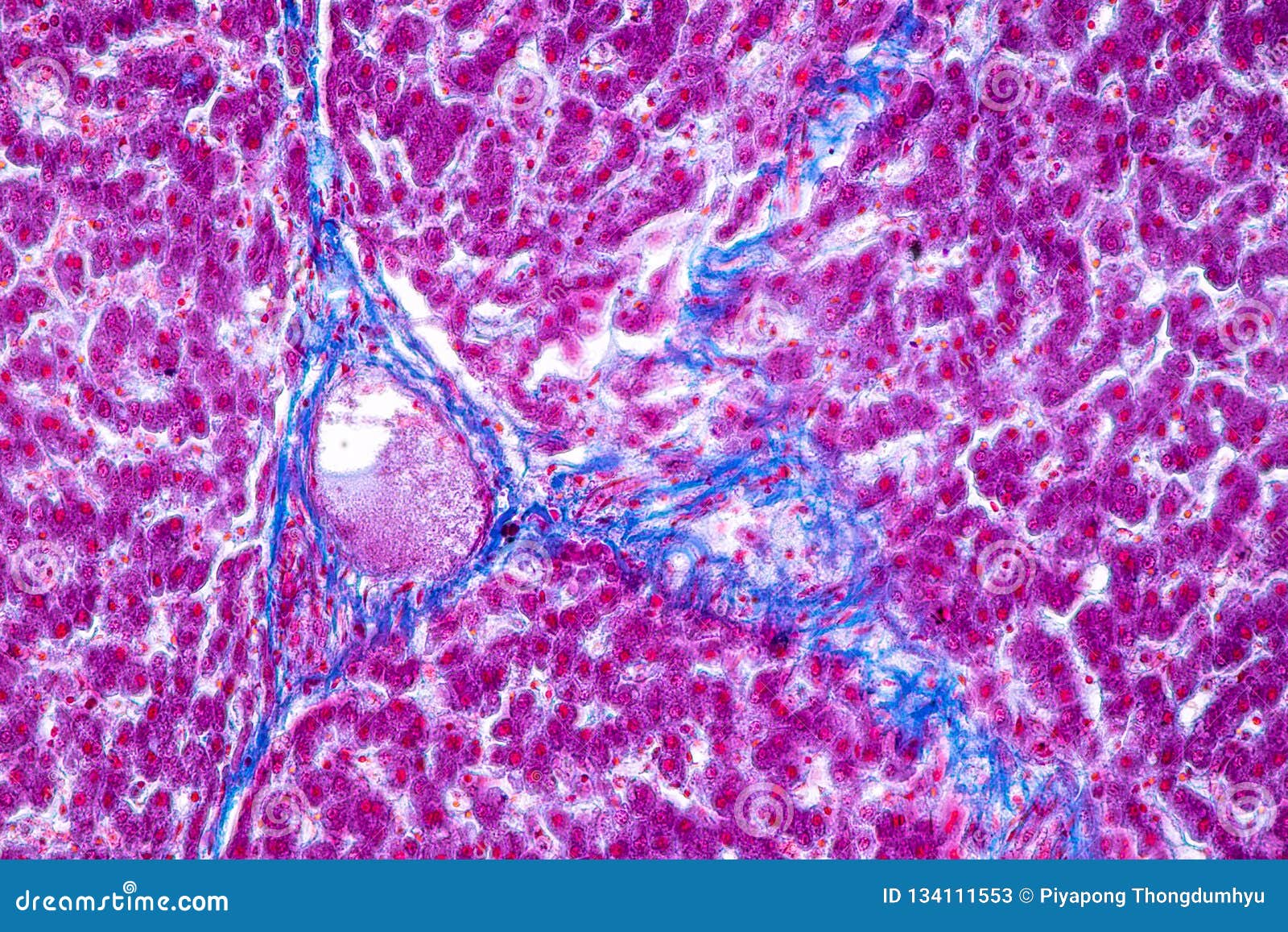 Tissue Of Liver Under The Microscope For Education Stock Image Image