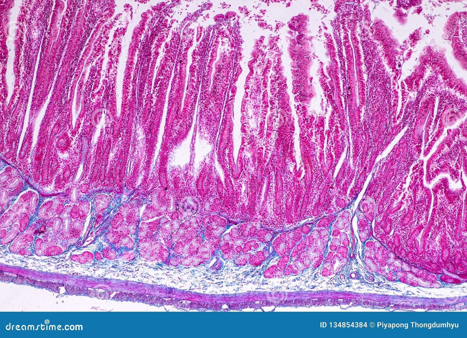 Histology Of Jejunum Micrograph Royalty Free Stock Photo histology-of-jejunum-micrograph-royalty-free-stock-photo