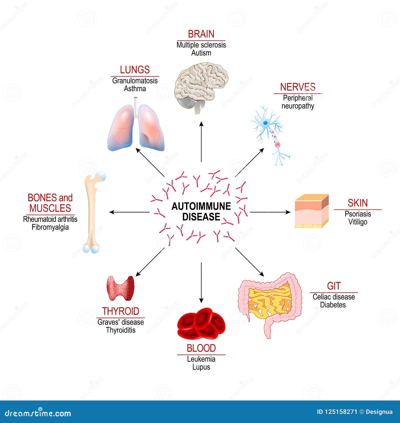 tissues of the human body affected by autoimmune attack