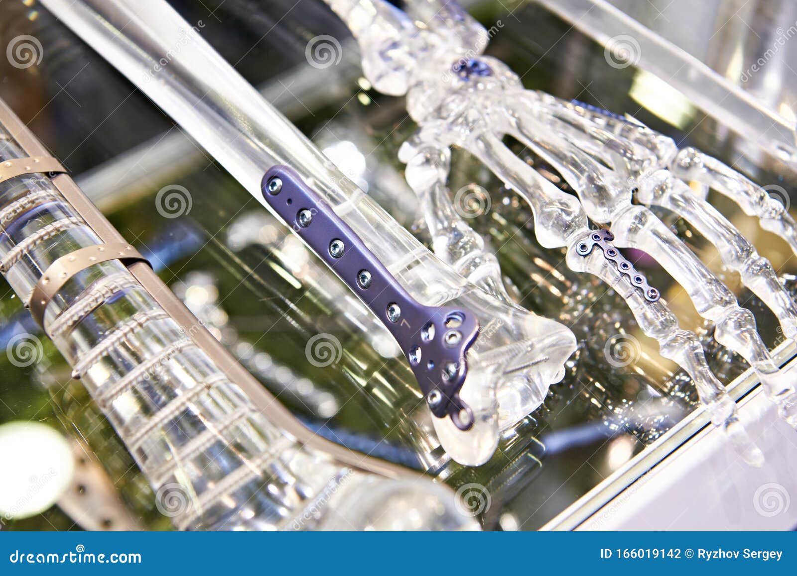 Titanium Plates for Splicing Bones Stock Photo Image of fixation