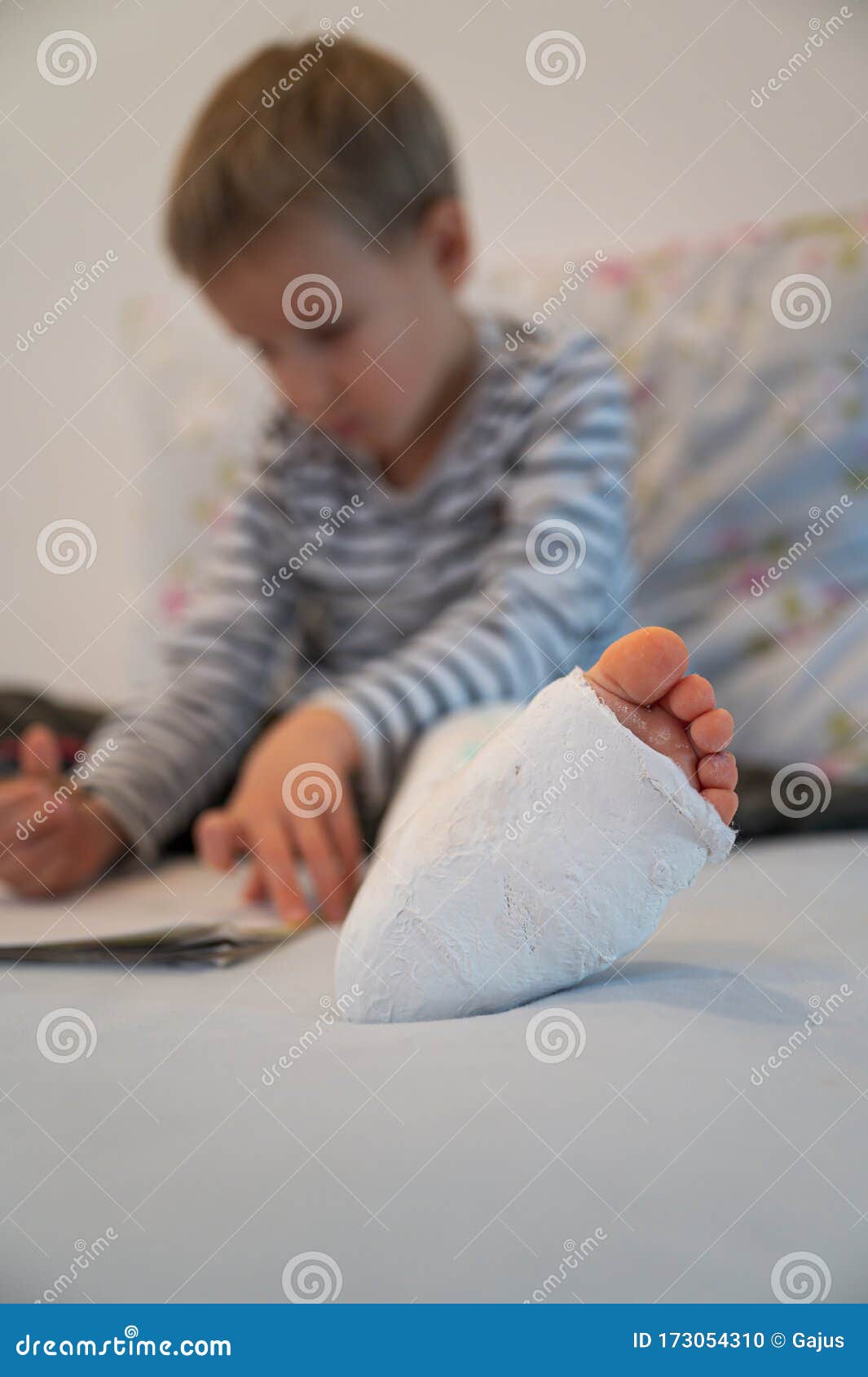 Toddler Boy with Broken Leg in a Cast Stock Photo Image of broken