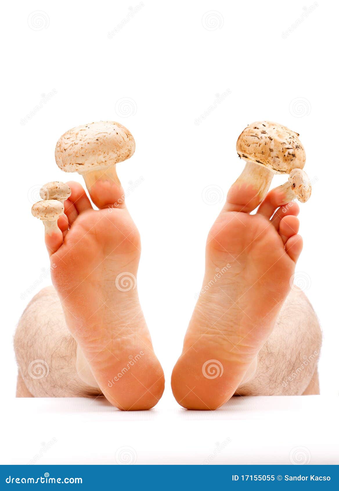 toe nail and skin fungus