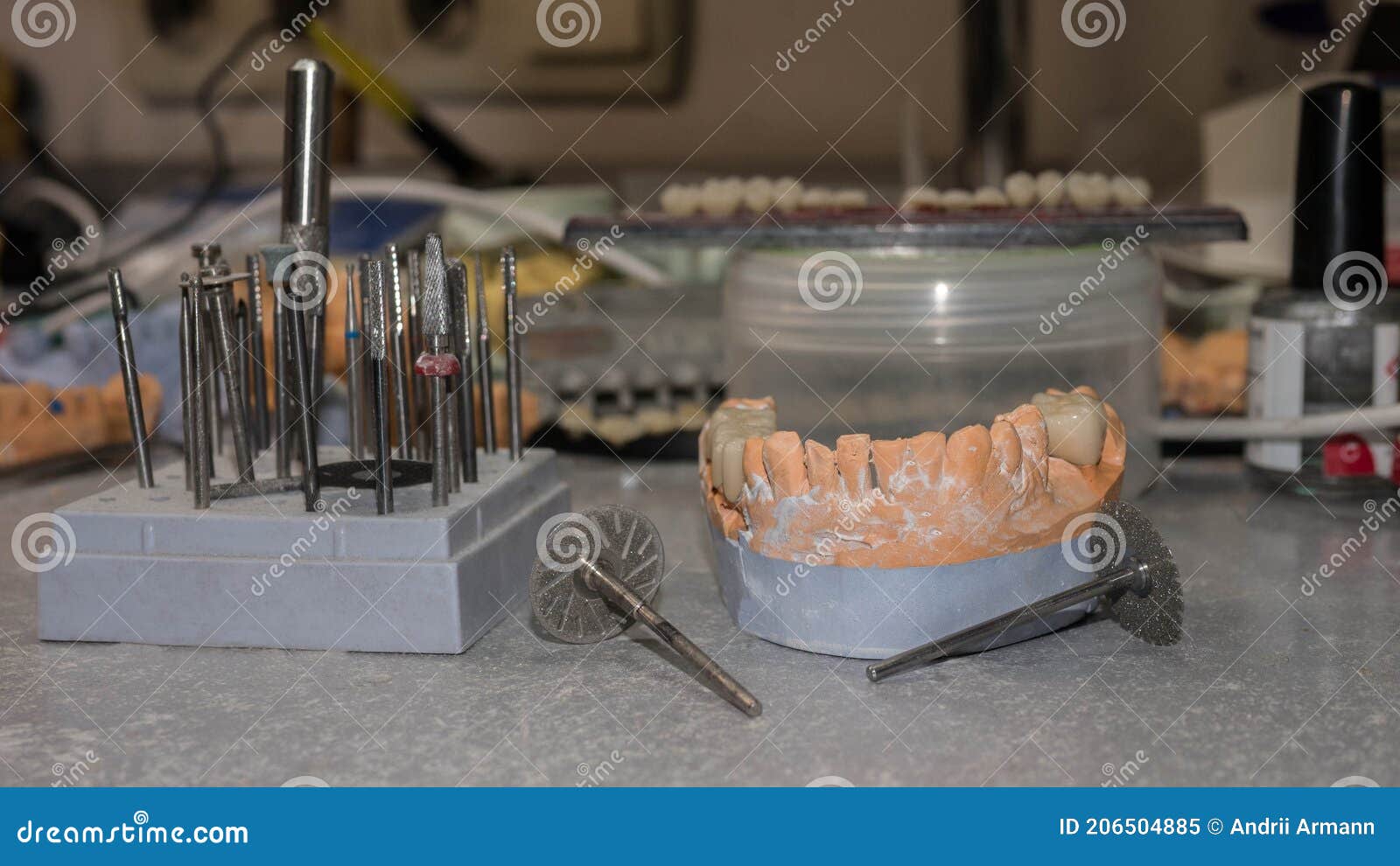 Ceramic Crown of a Tooth Based on a Plaster Model of Teeth, the Work of