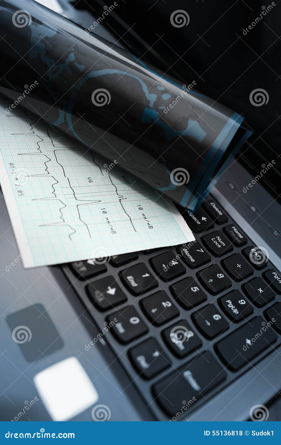 Tools of Medical Examination on the Keyboard Stock Photo Image of