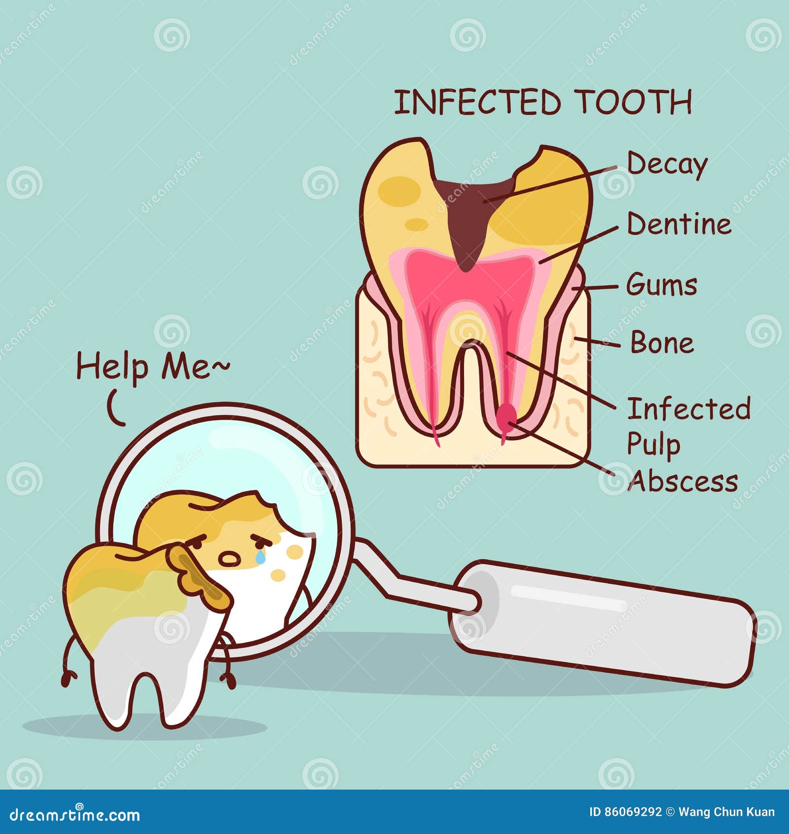 tooth decay with health problem