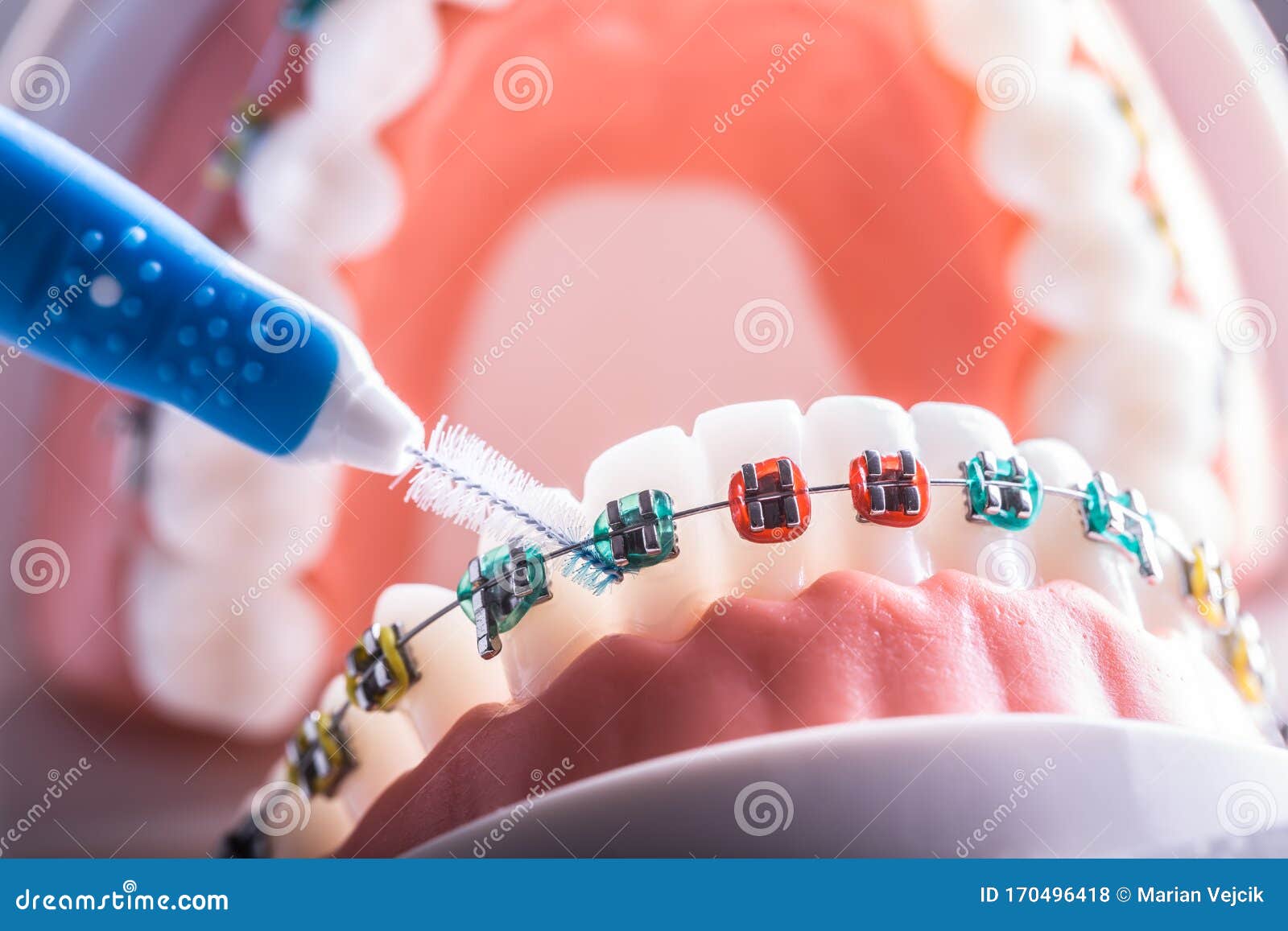 tooth model from dental braces with inter dental teeth cleaning brush
