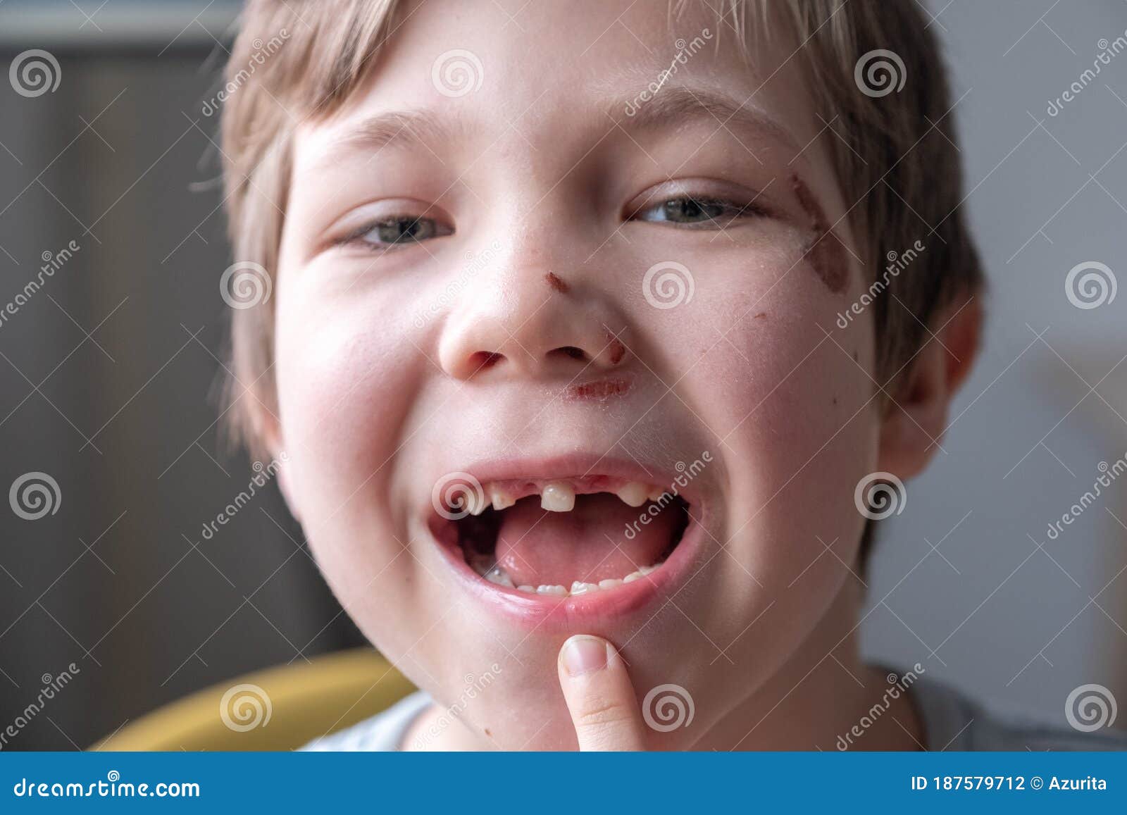 Portrait Of A Little Toothless Girl. Stock Photo - Image 