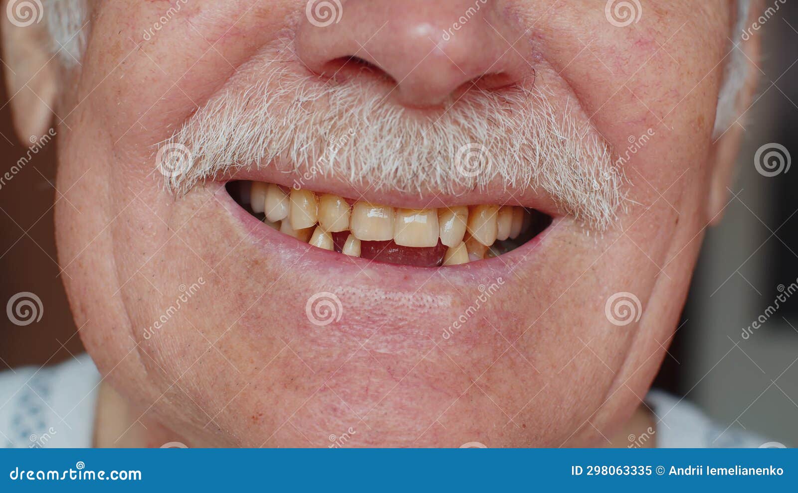 Toothless Male Smile Mouth of Senior Elderly Old Man, Dental Problem