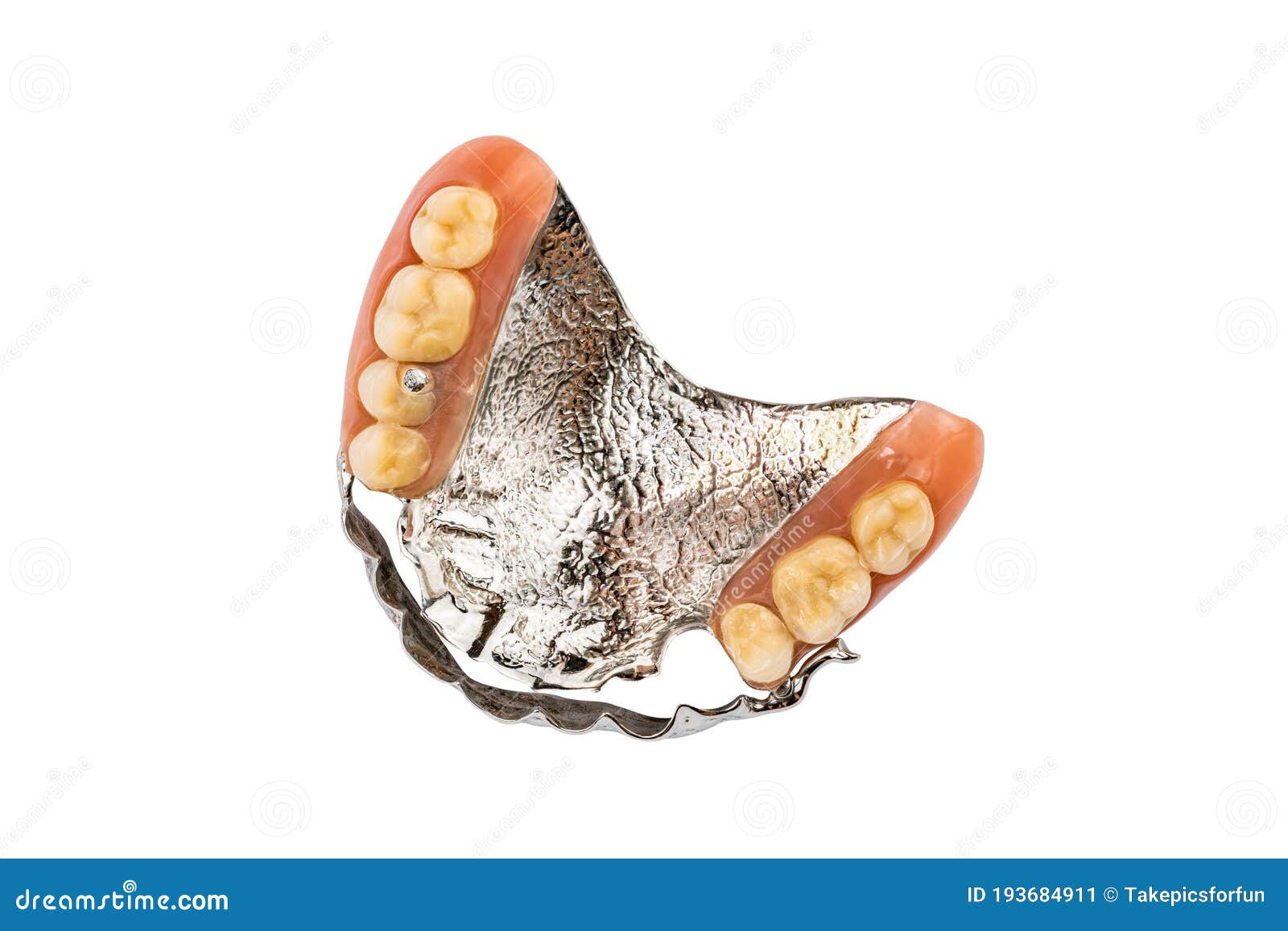 Metal Denture. Arch Prosthetics. False Teeth. Clammer Upper Removable