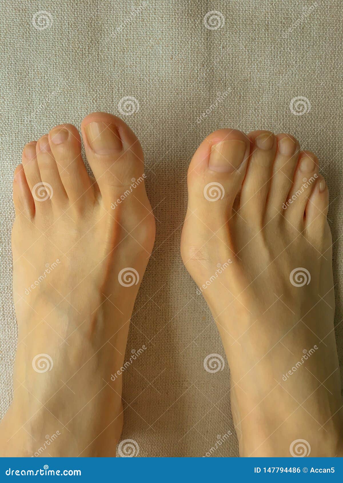 Top Viewand Closeup Photo of Woman Feet and Natural Toenails without Nail  Polish Stock Photo - Image of home, closeup: 147794486