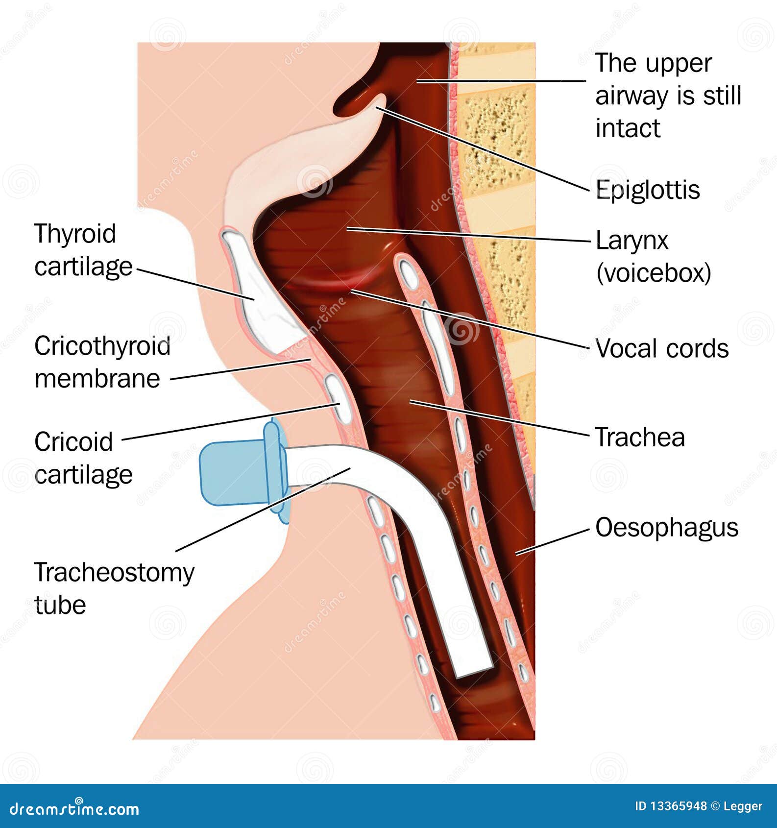 tracheostomy procedure anatomy